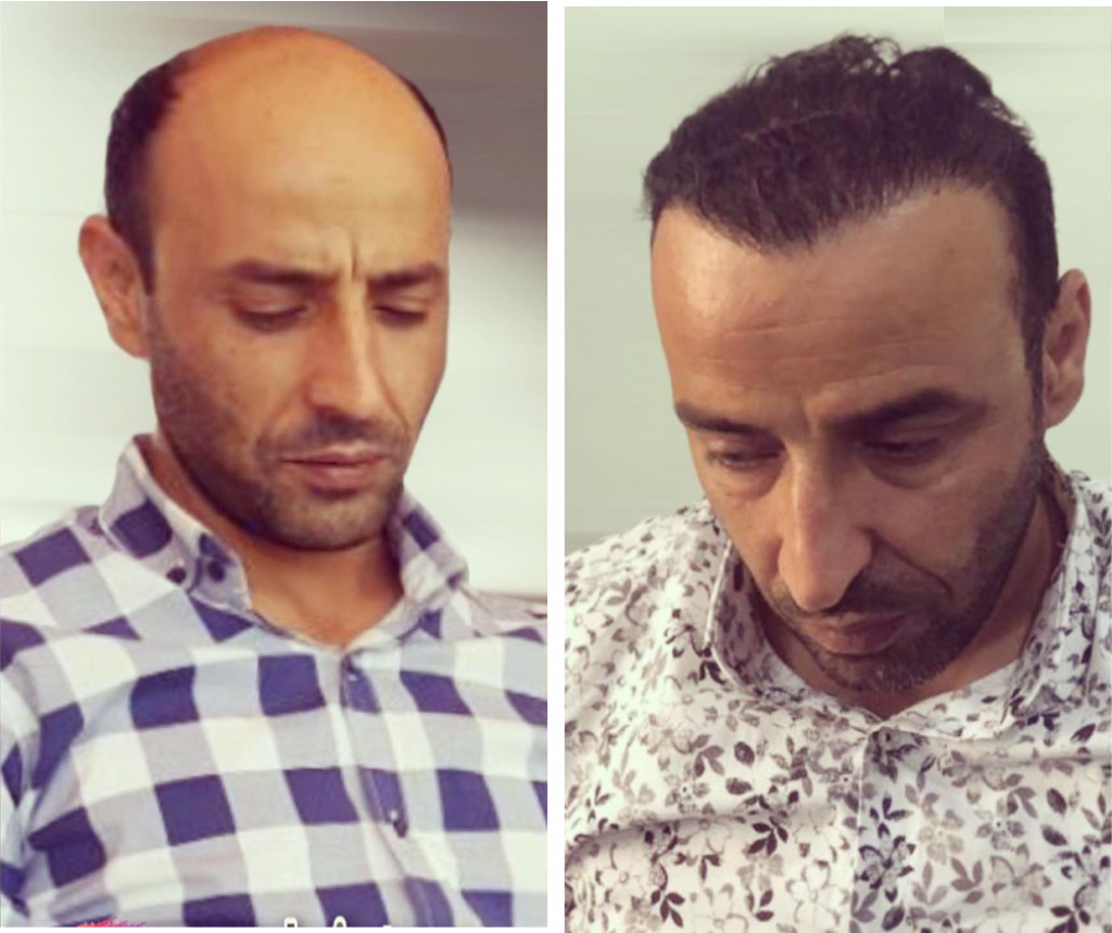 волосы в махачкале