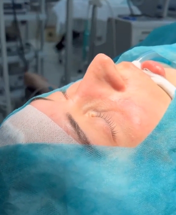 Ринопластика